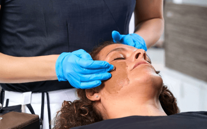 Close-up of a Cosmelan Depigmentation Peel at The Wellness Ed — a clinician in royal-blue medical gloves carefully smooths the signature warm-amber Cosmelan mask across a relaxed guest's cheek, the even, professional application visibly targeting melasma and stubborn pigmentation.