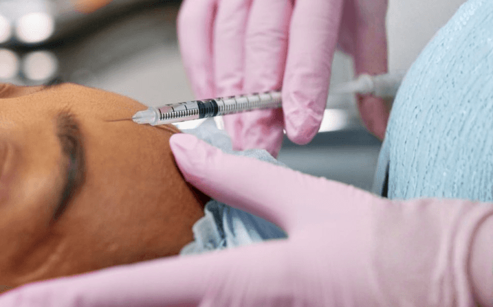 Close-up of an NCTF Mesotherapy session at The Wellness Ed — a clinician in pink medical gloves precisely administers a fine micro-injection of the NCTF revitalising cocktail into a guest's forehead, the steady, gentle technique characteristic of an in-clinic, doctor-led mesotherapy protocol.