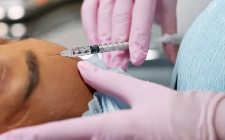 Close-up of an NCTF Mesotherapy session at The Wellness Ed — a clinician in pink medical gloves precisely administers a fine micro-injection of the NCTF revitalising cocktail into a guest's forehead, the steady, gentle technique characteristic of an in-clinic, doctor-led mesotherapy protocol.
