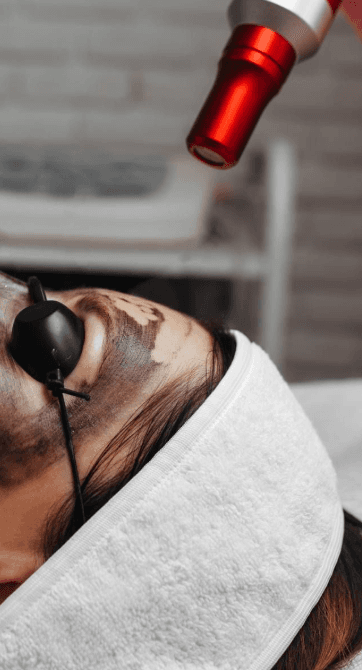 A relaxed client wearing a soft white headband and protective eyewear during a Carbon Facial at The Wellness Ed Signature Studio, with a fine carbon mask on the skin and a laser handpiece guided gently above the cheek.