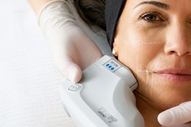 Close-up of a HIFU facial-lifting session at The Wellness Ed — a clinician in white gloves glides a precision ultrasound applicator across a guest's cheek and jawline, with treatment grid markings visible on the skin and a soft black headband holding her hair back.