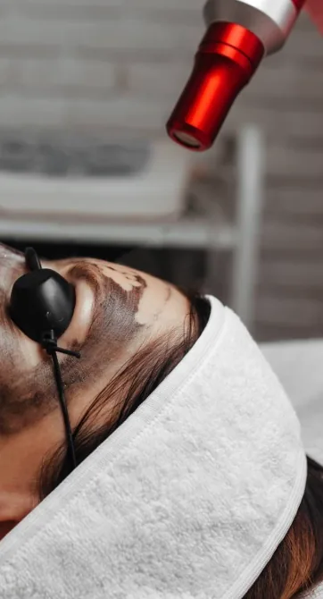 A relaxed client wearing a soft white headband and protective eyewear during a Carbon Facial at The Wellness Ed Signature Studio, with a fine carbon mask on the skin and a laser handpiece guided gently above the cheek.